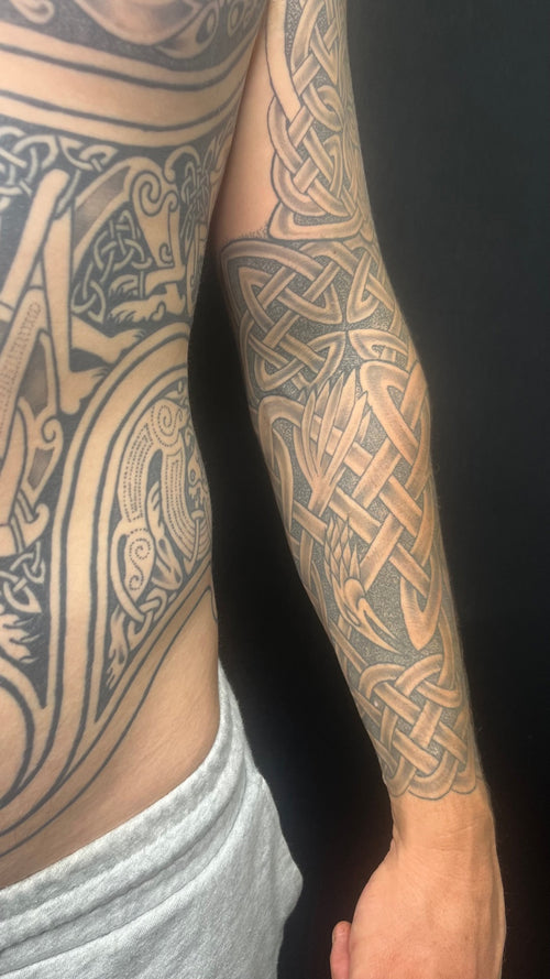 Laser Tattoo Removal (Cosmetic and Body Art Removal) Ebook Only